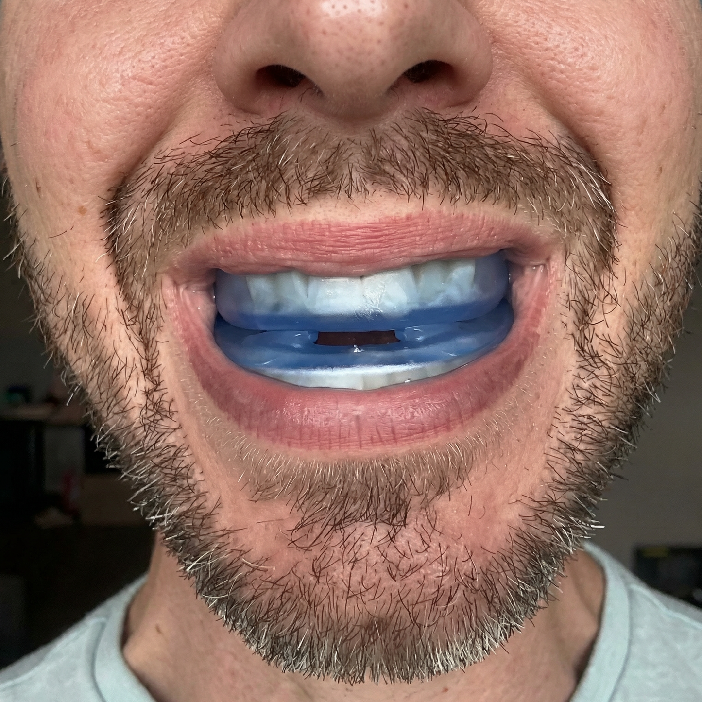 Тихо Устройство Против Хъркане - Универсален Размер